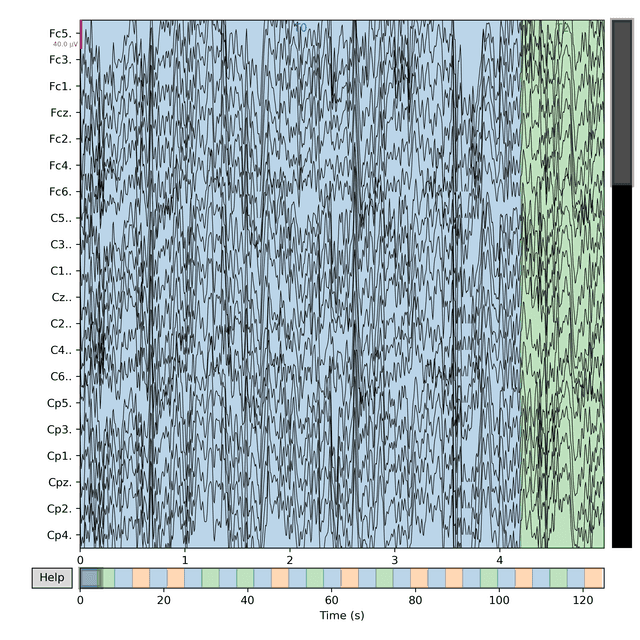 Band-pass filtered EEG signal waveform