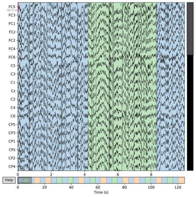 EEG signal after manual artifact removal