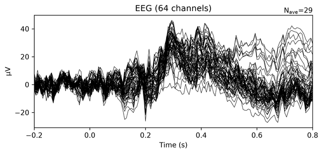 Epoch visualization across channels